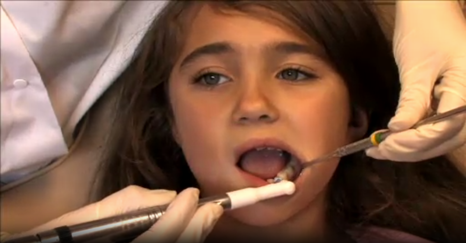 Pediatric Teeth Cleaning